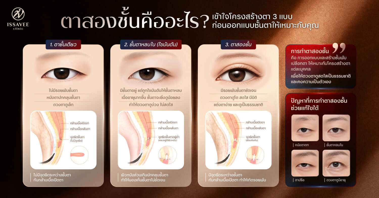 เปรียบเทียบตาชั้นเดียว ชั้นตาหลบใน และตาสองชั้น