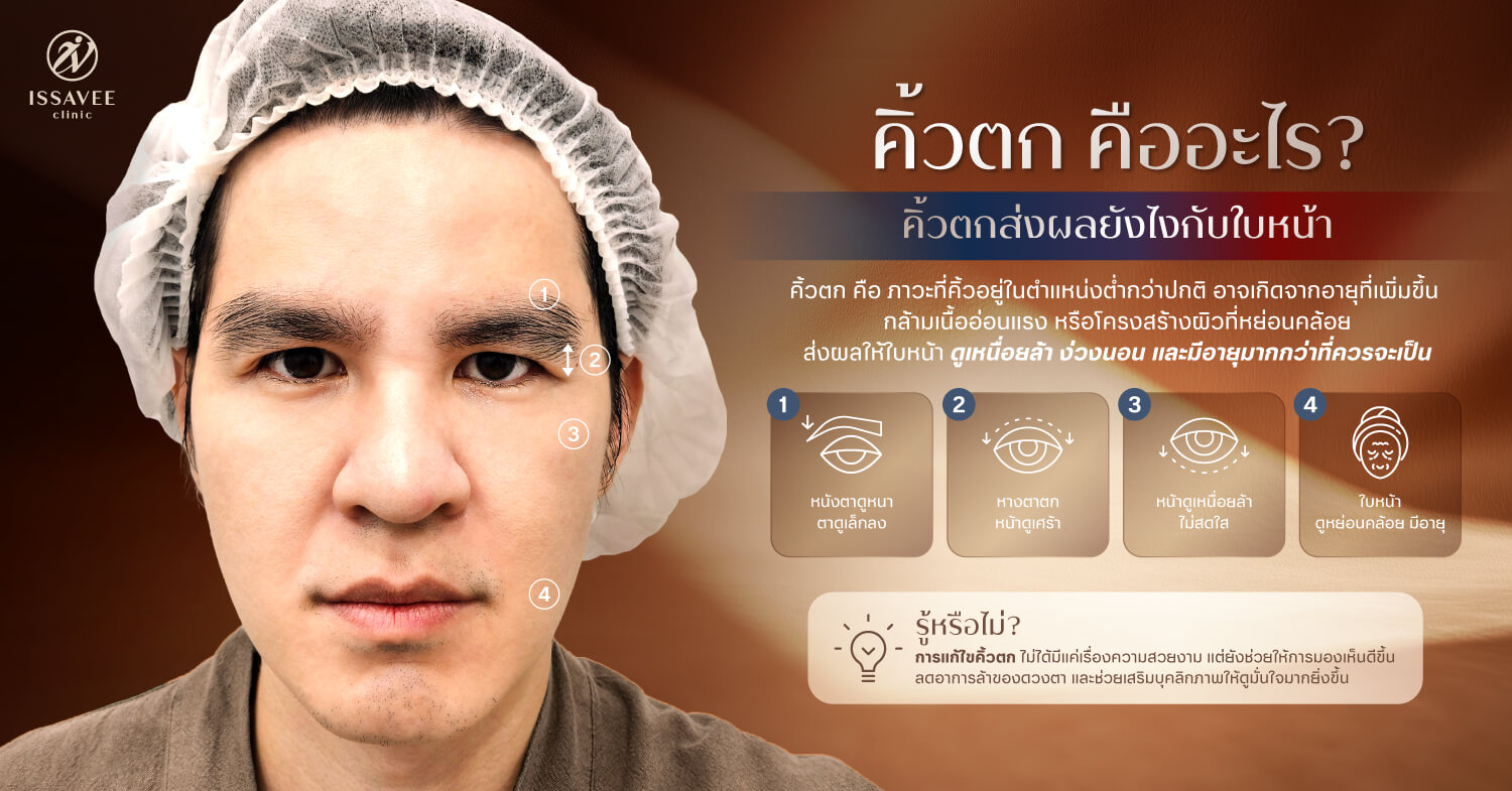 "ลักษณะคิ้วตกที่ทำให้หน้าดูเหนื่อย"