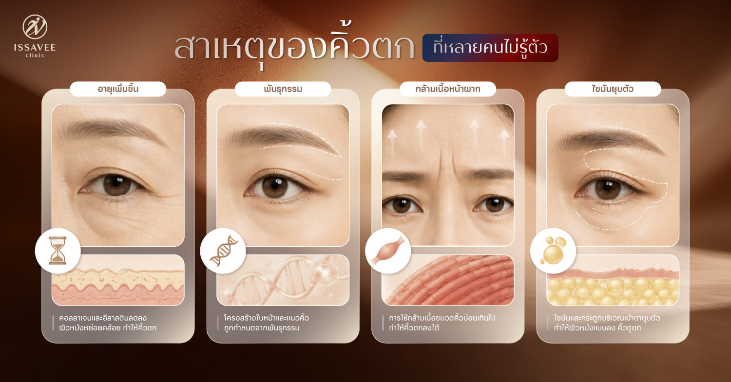 "สาเหตุของคิ้วตกเมื่ออายุมากขึ้น"