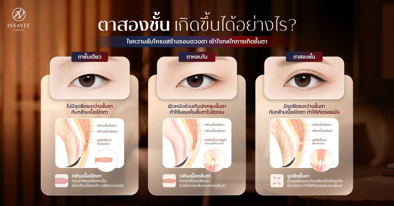 กายวิภาคการเกิดตาสองชั้นจากกล้ามเนื้อเปิดตาและจุดยึดชั้นตา