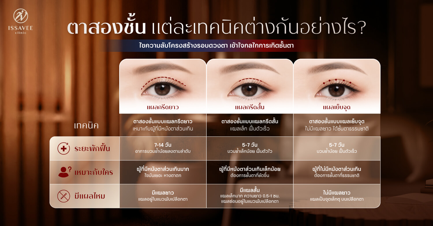 เปรียบเทียบเทคนิคทำตาสองชั้นแบบกรีดยาว แผลสั้น และเย็บจุด