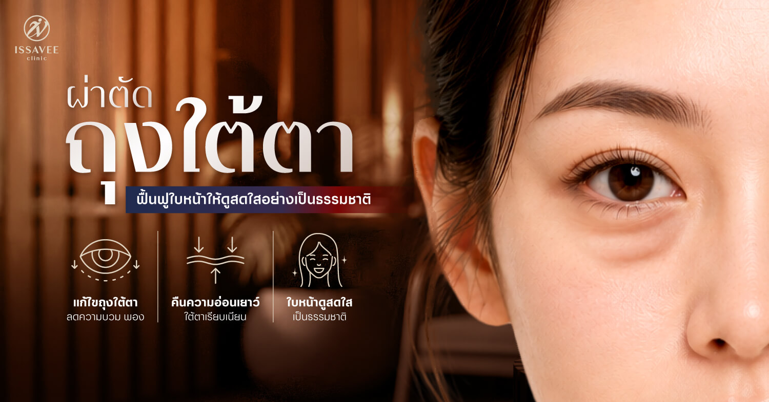 วิธีแก้ตาโหลลึกด้วยการย้ายไขมันและเติมไขมันรอบดวงตา